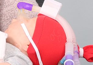 Bubble CPAP